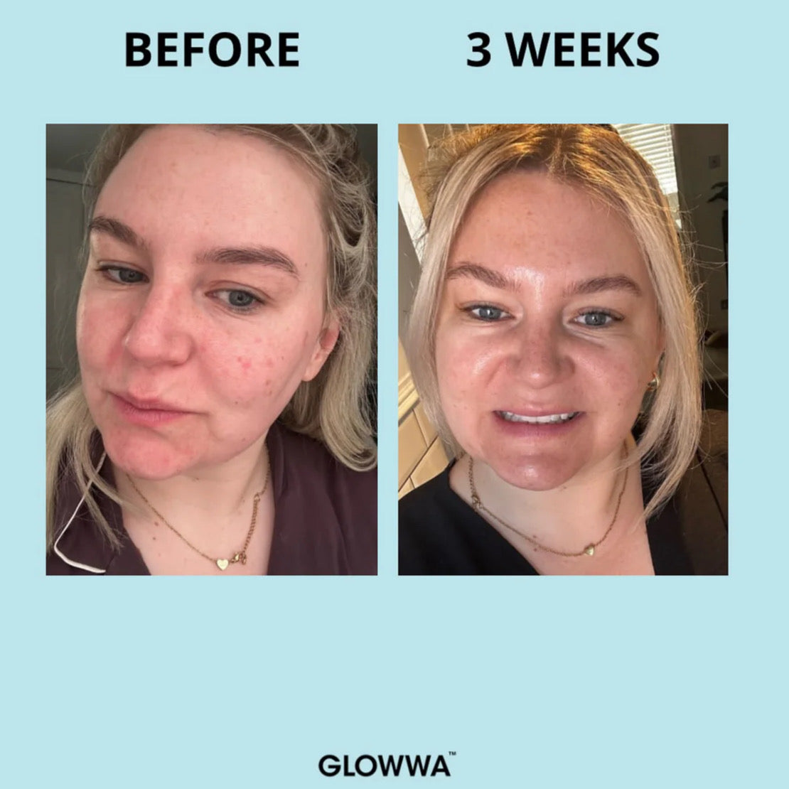 COLLAGEN CREAMER